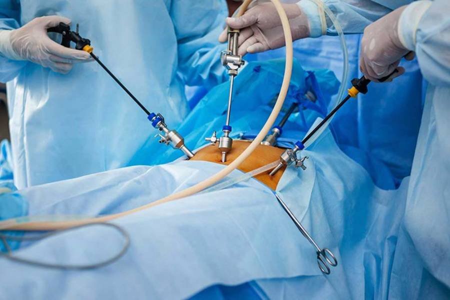 Advanced Laparoscopic Surgeries